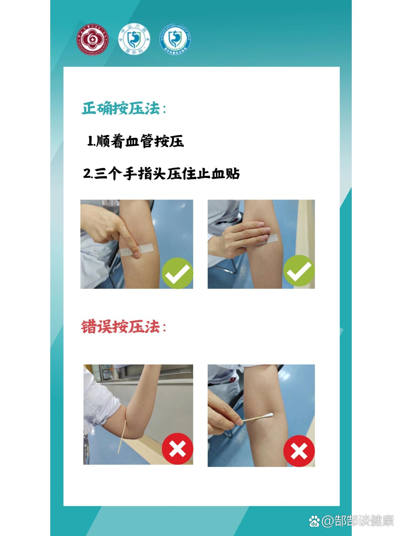 很多人抱怨采血后或者输完液,针眼处有一片淤青,可能就是因为按压的