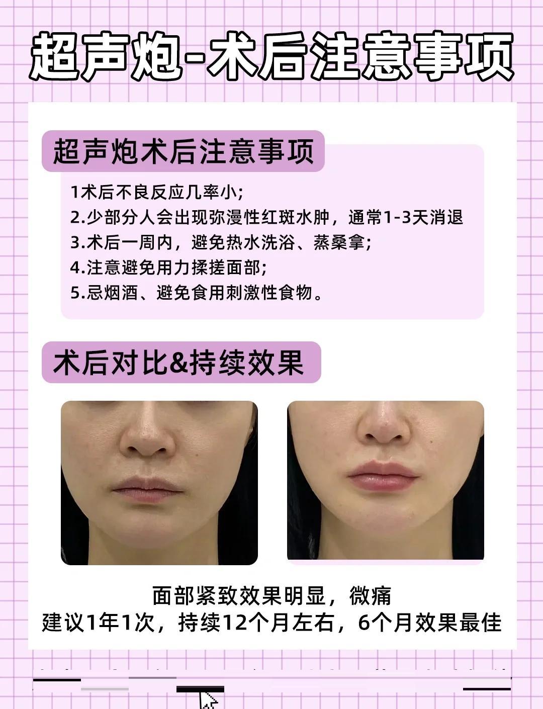 抗衰必看！