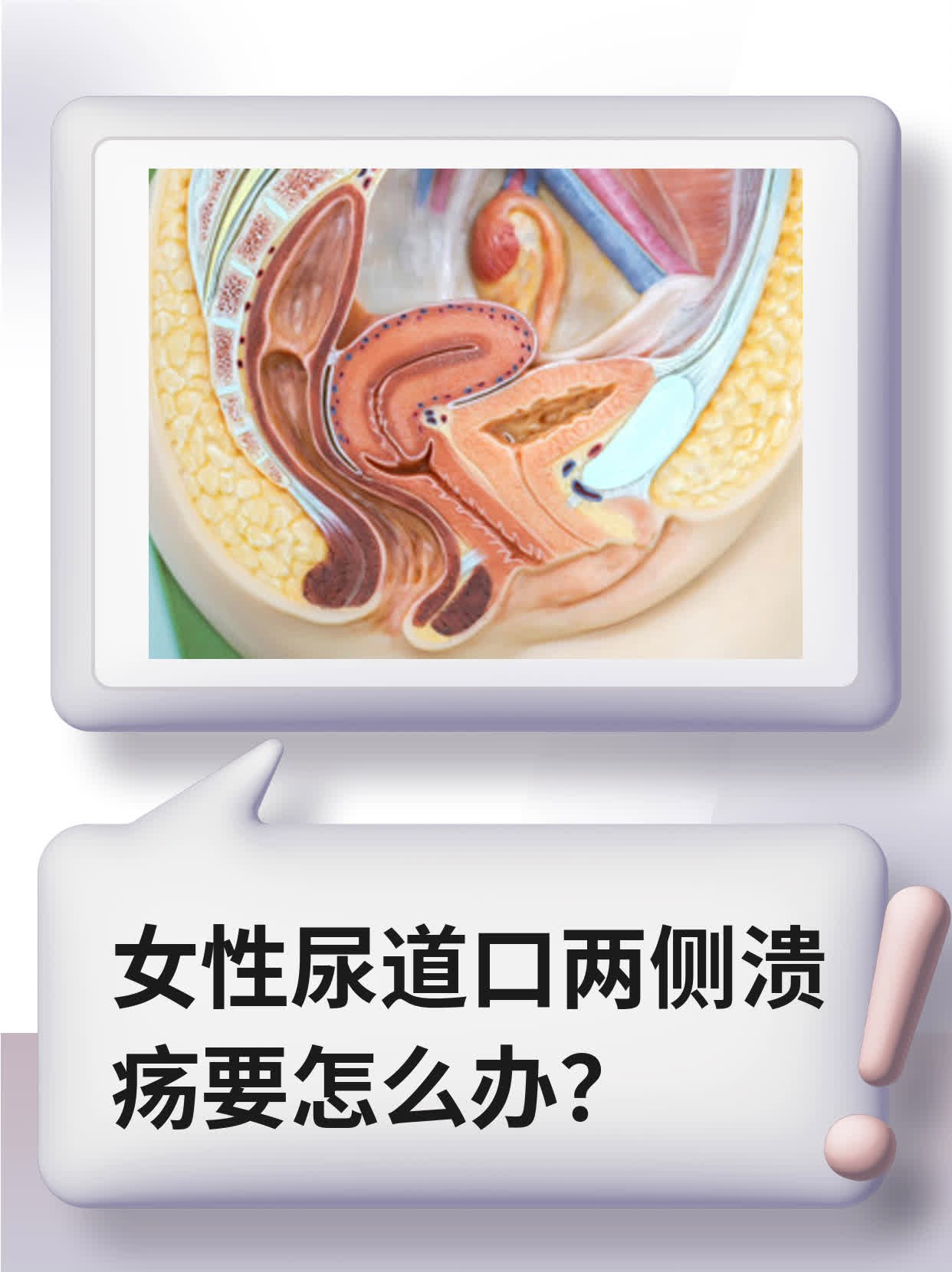 女性尿道口两侧溃疡要怎么办