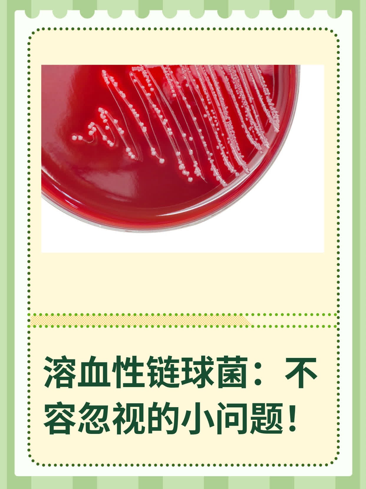 溶血性链球菌:不容忽视的小问题