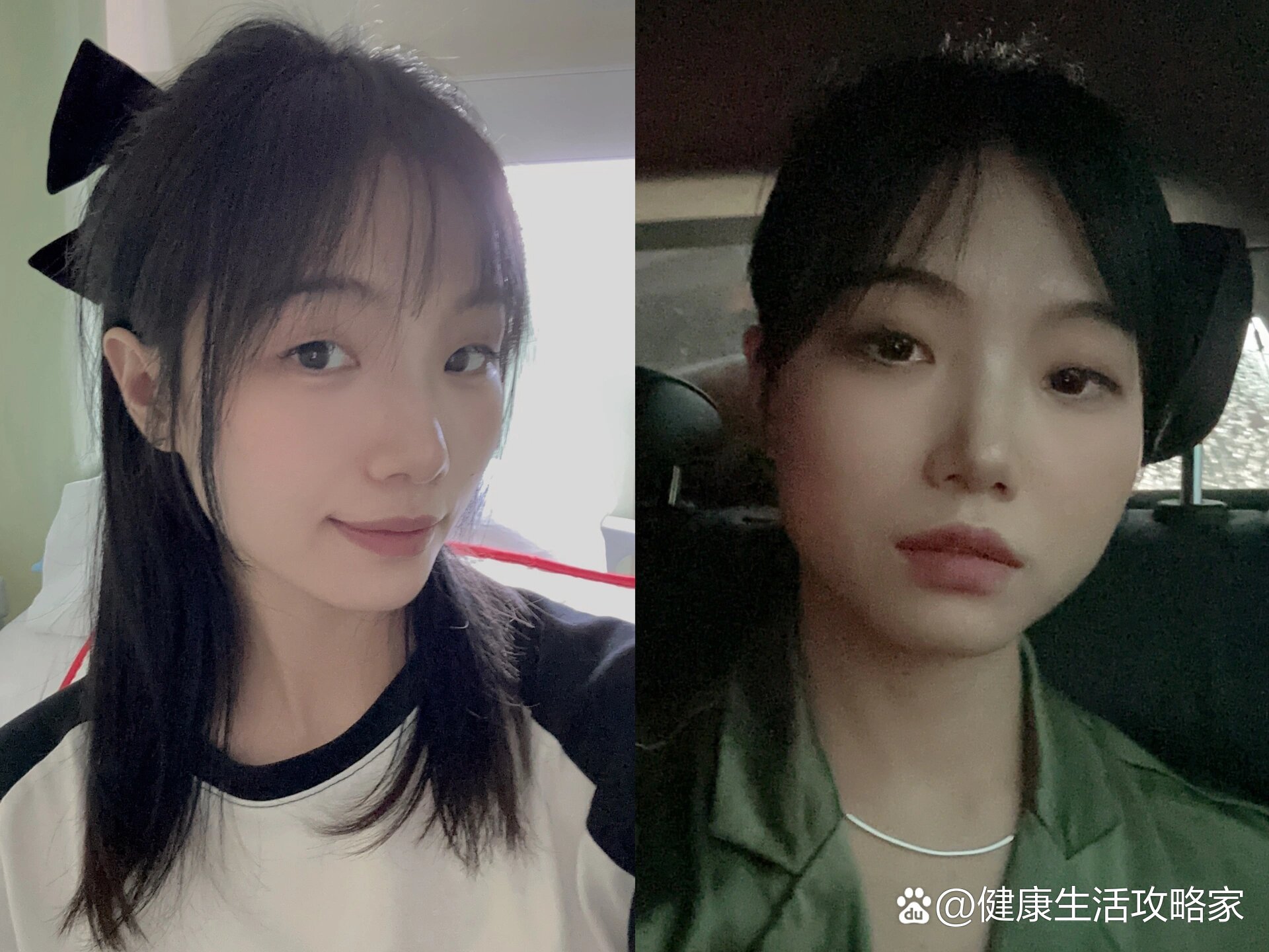 【左滑】口服激素药甲泼尼龙1个月.