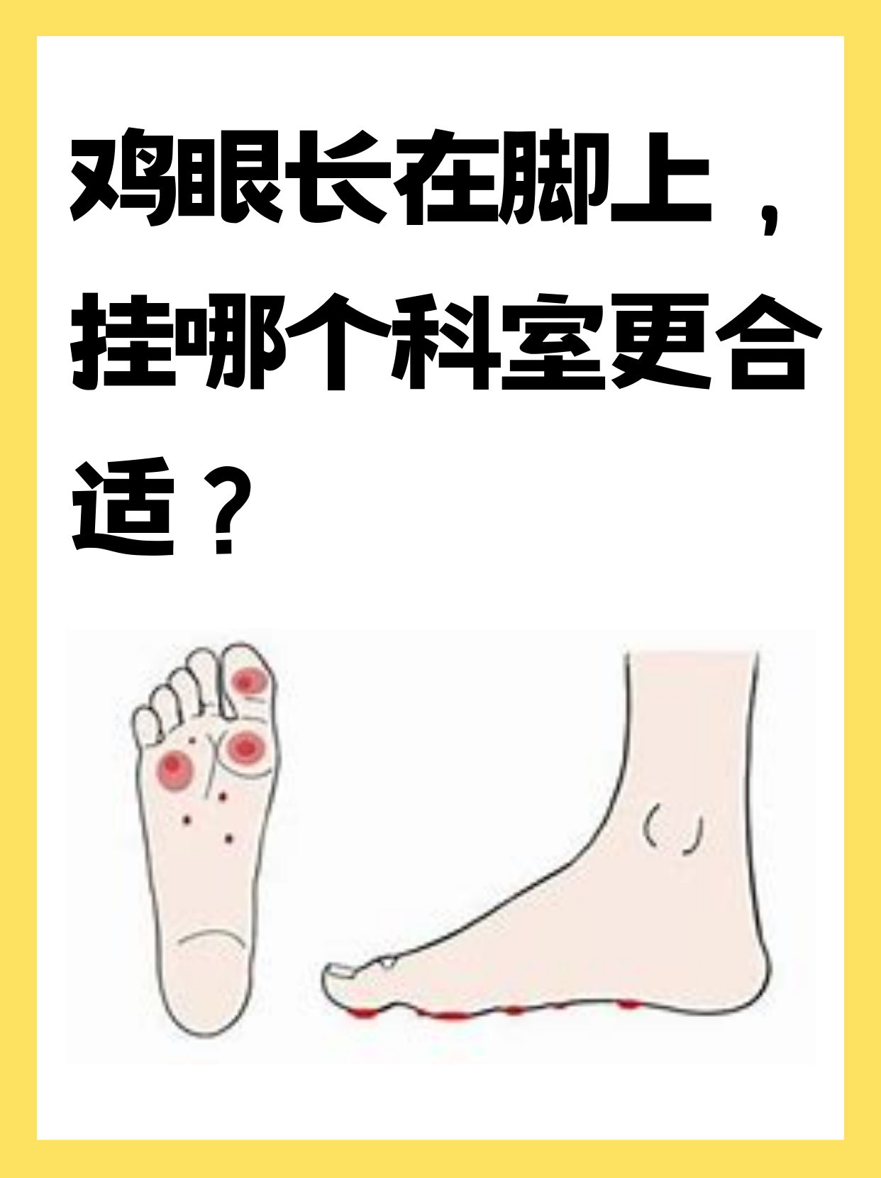 脚疼挂号什么科(脚痛挂什么号看医生)