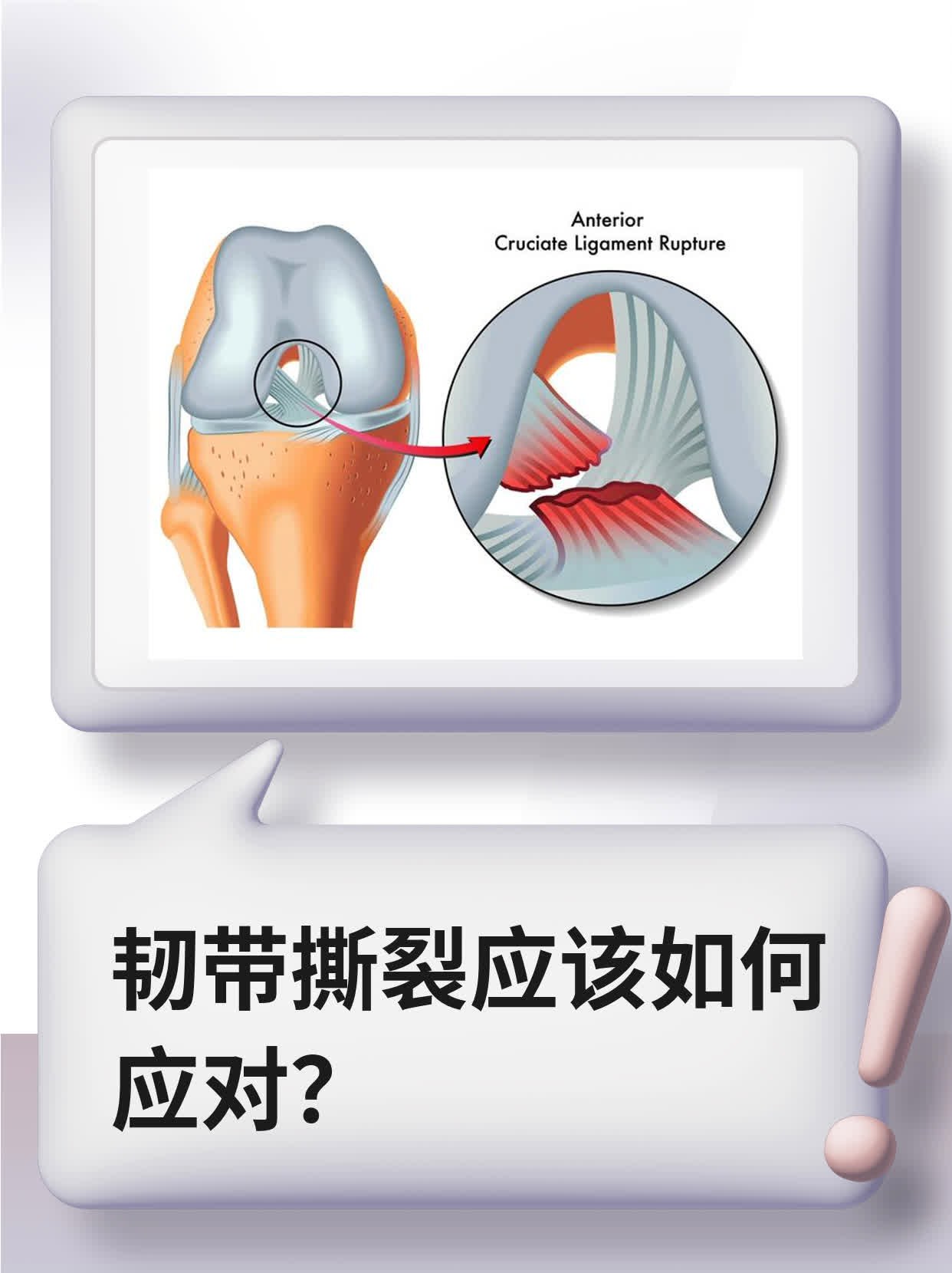 韧带撕裂应该如何应对