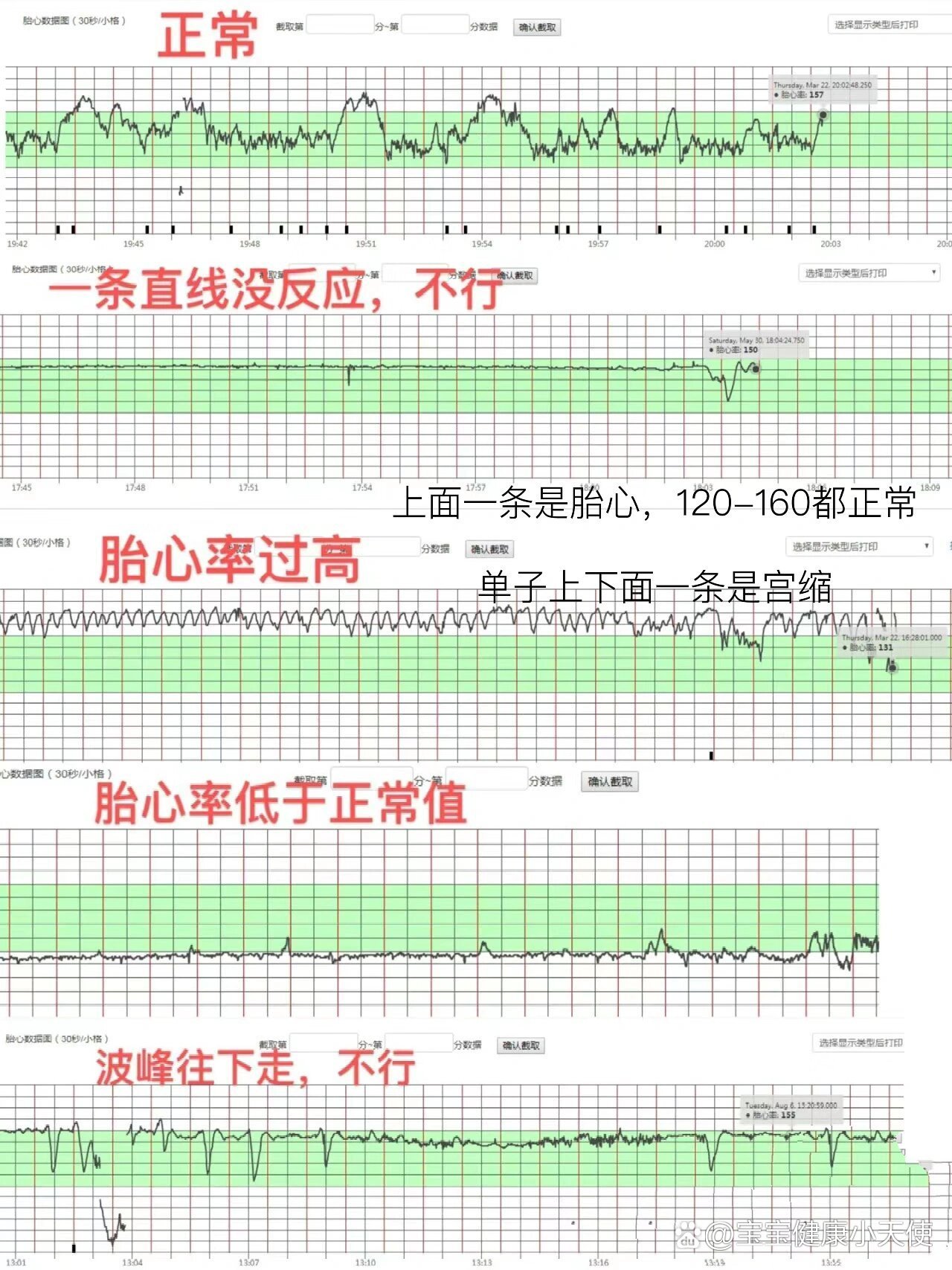 孕期胎心率对照表图片