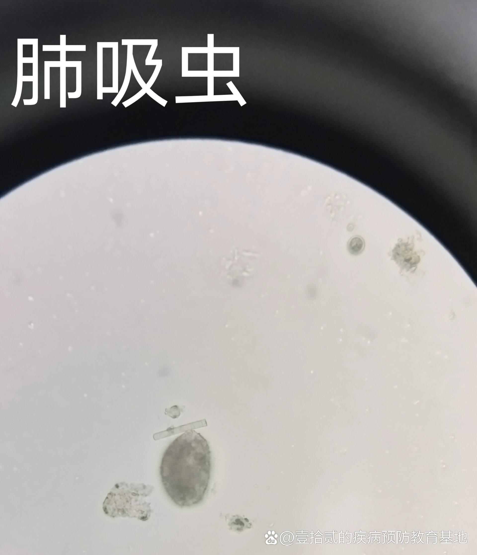 寄生虫镜下观察图片分享