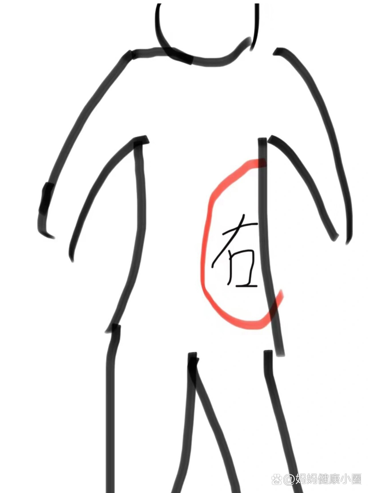 孕妇右侧腰疼