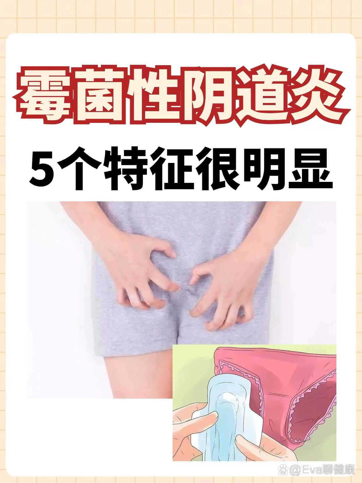 女性得性疾病前兆图片图片