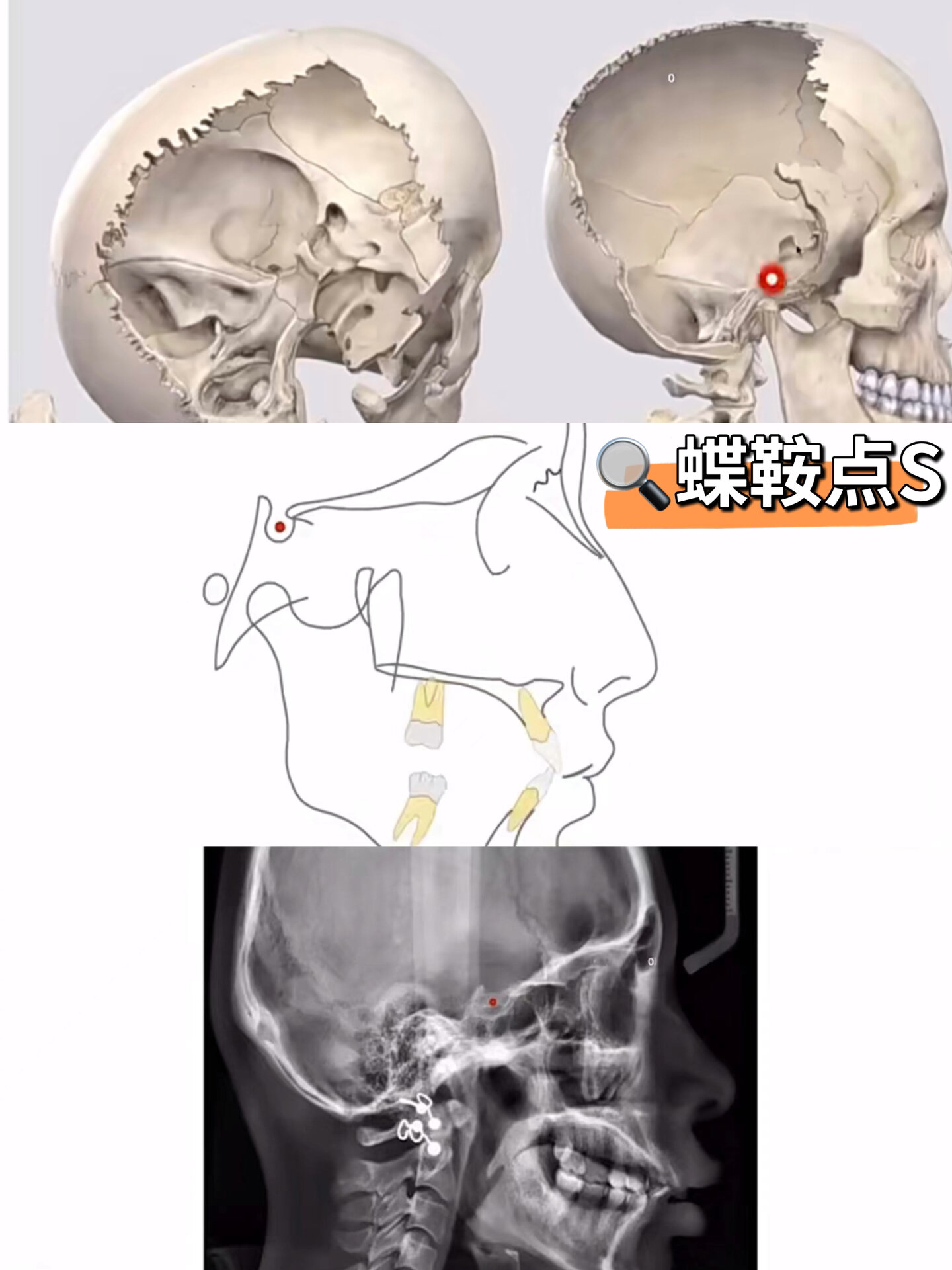 正畸新手❗️头影测量