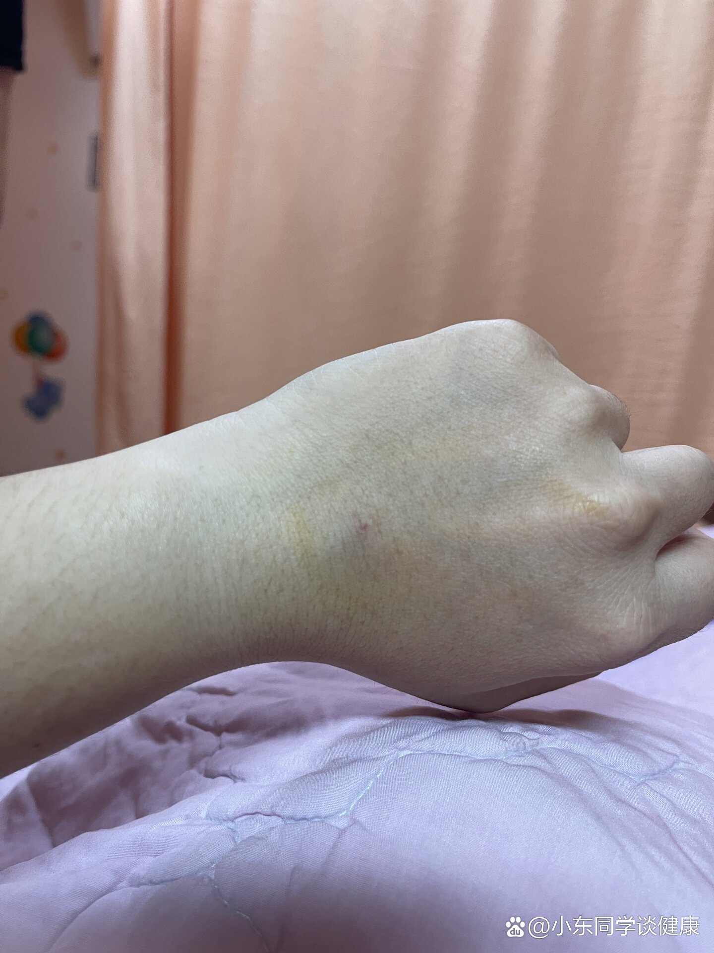 溶血是什麼意思啊?