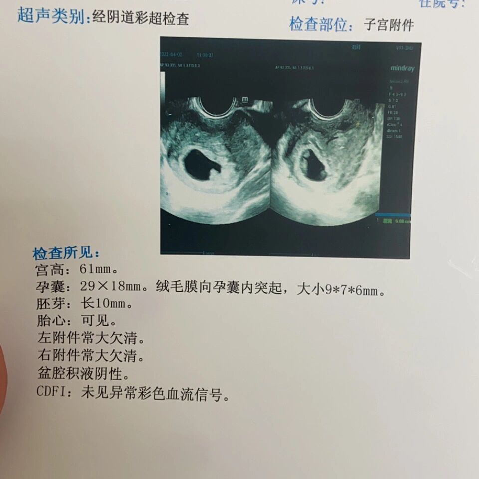 孕8周