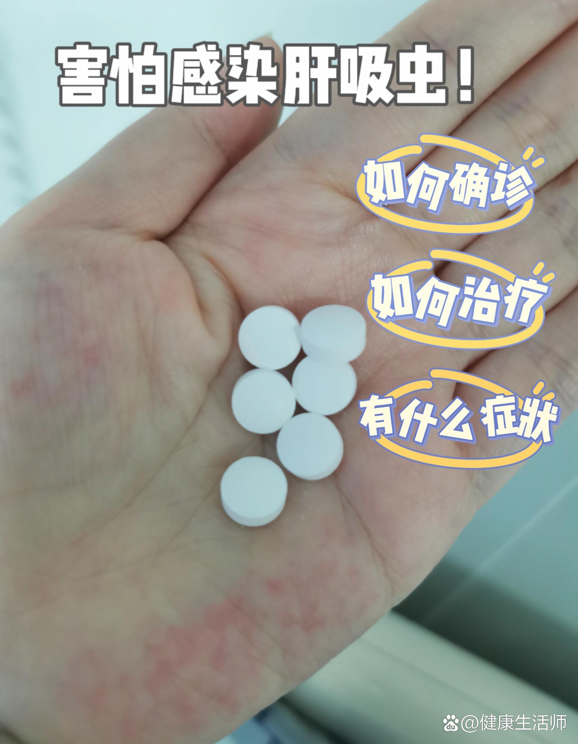 吃顺德鱼生感染肝吸虫的血泪经验