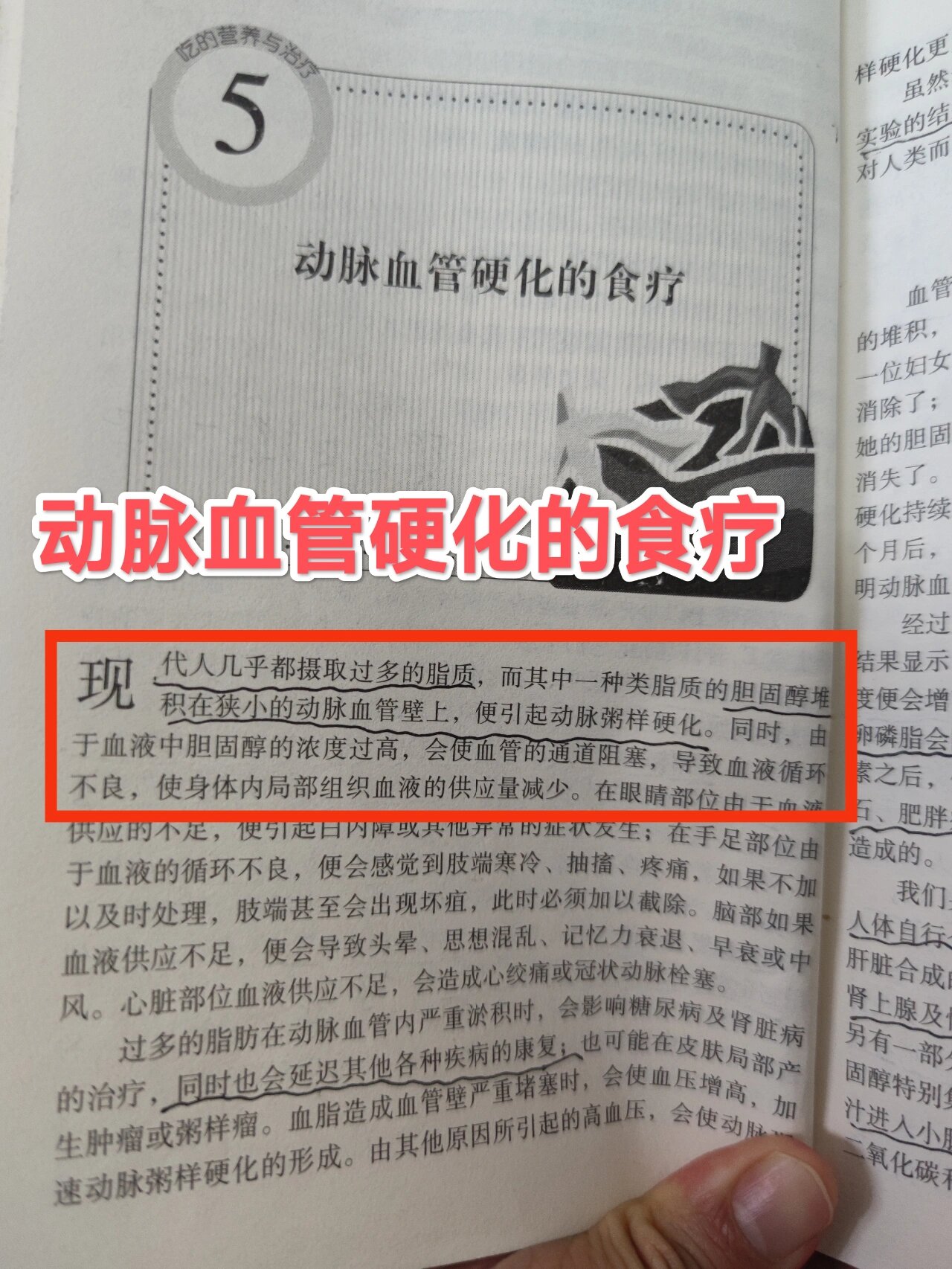 动脉血管硬化怎么办?