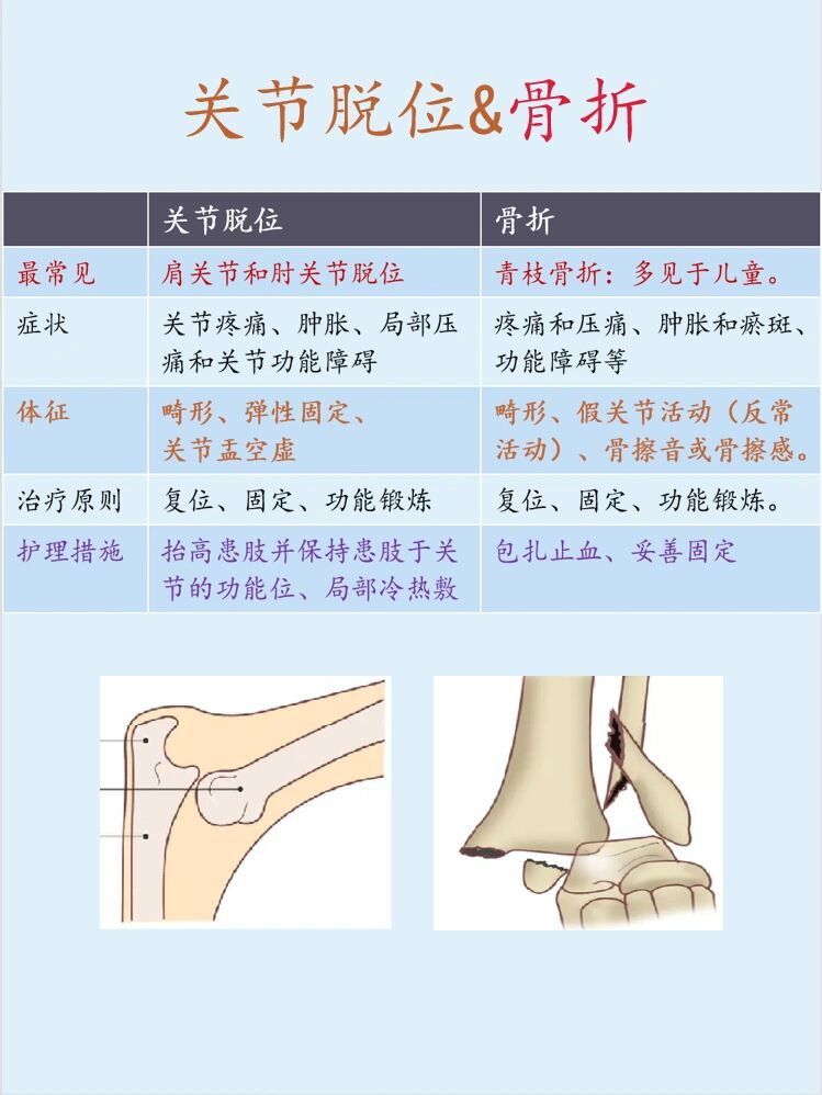 骨头脱臼原理示意图图片