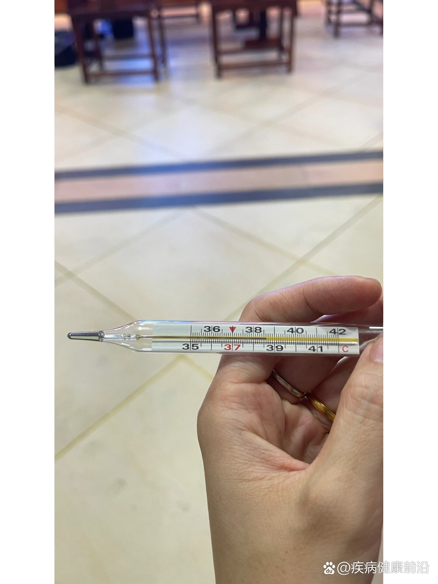 关于高烧,有惊厥史的,38度就可以喝退烧药了