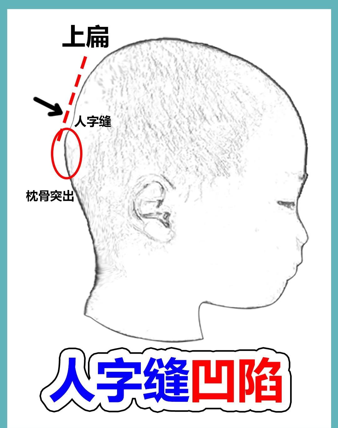 宝宝头型矫正：压枕骨的秘诀与误区解析