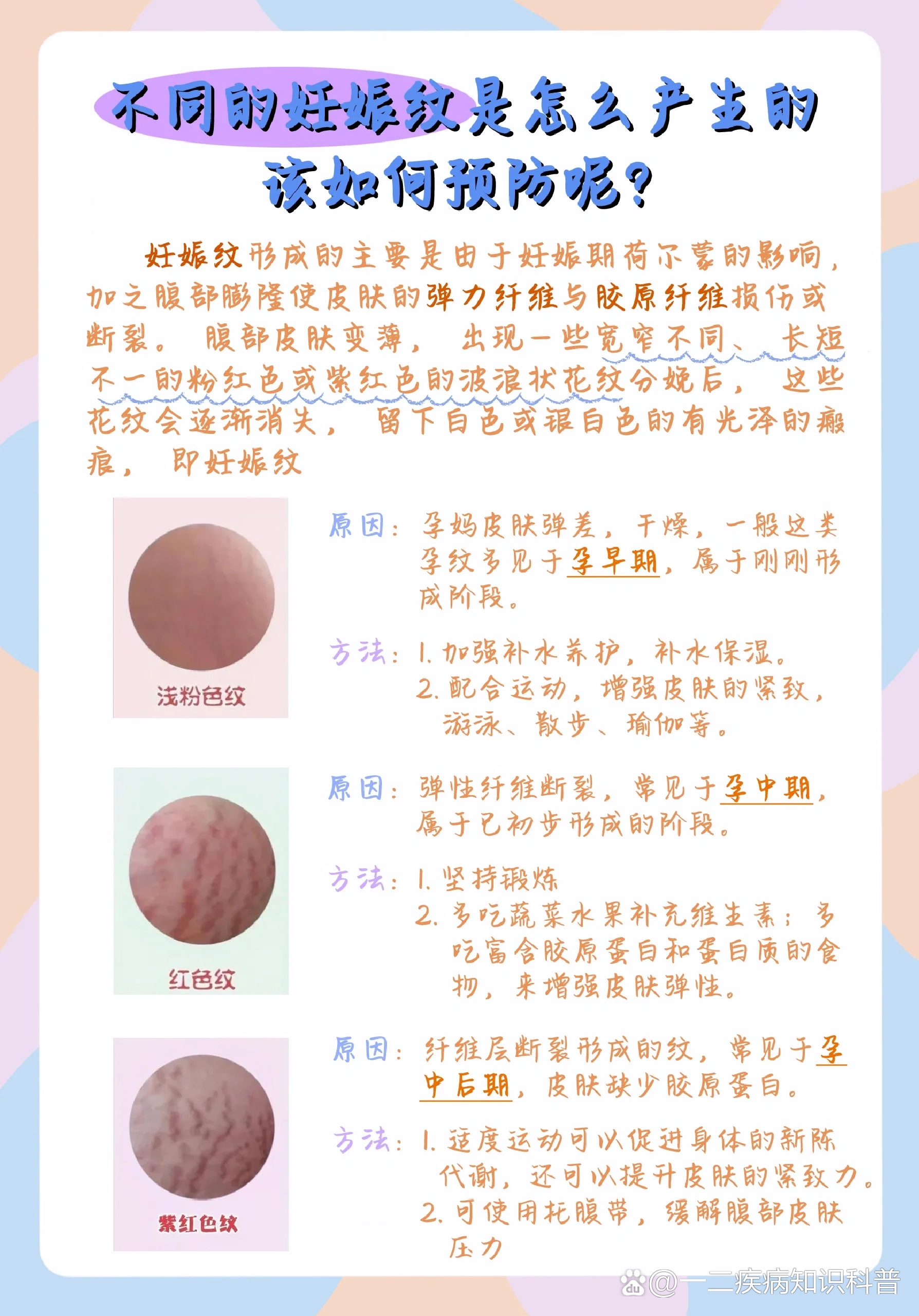 担心孕期长妊娠纹怎么办05快看过来7515
