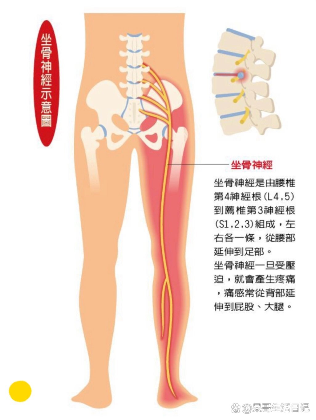 坐骨神经走行图解剖图图片