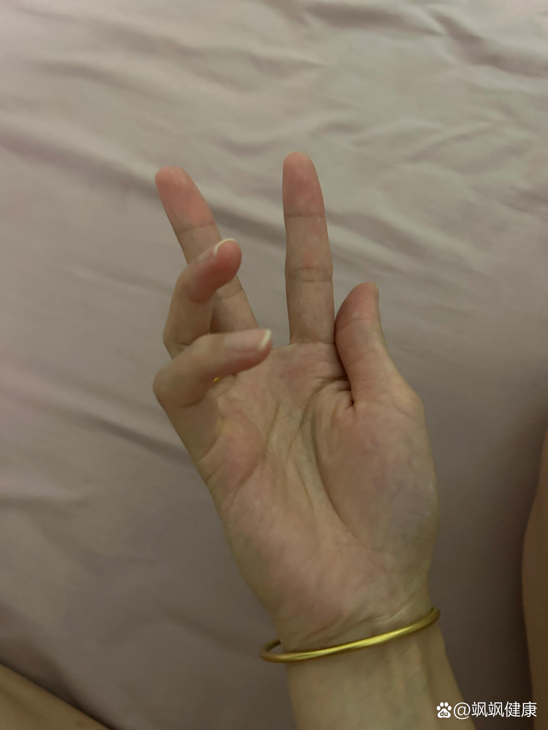 最近容易手麻鸡爪手动不了是啥情况