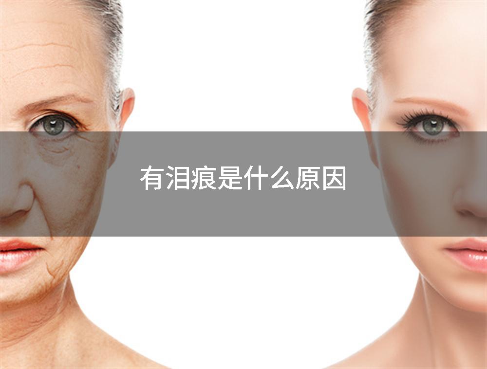 有泪痕是什么原因