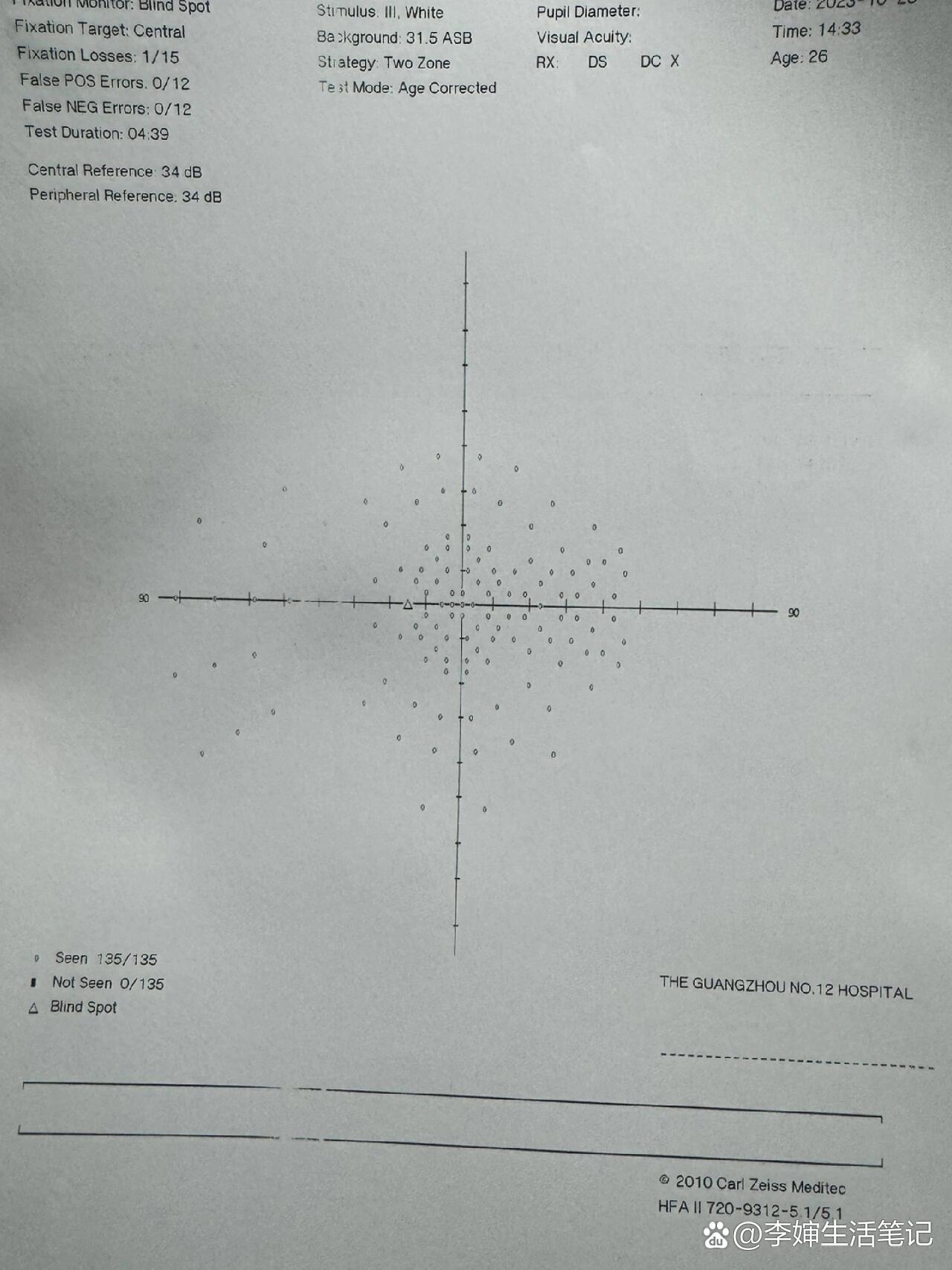 广州优眼水平视野检查攻略单眼弱视或者单眼矫正视力达不到5