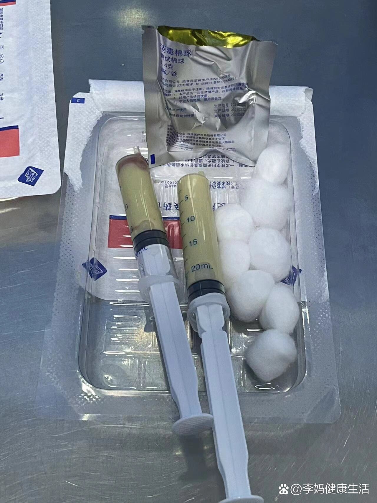 哺乳期乳腺炎化脓治愈经历分享(二)