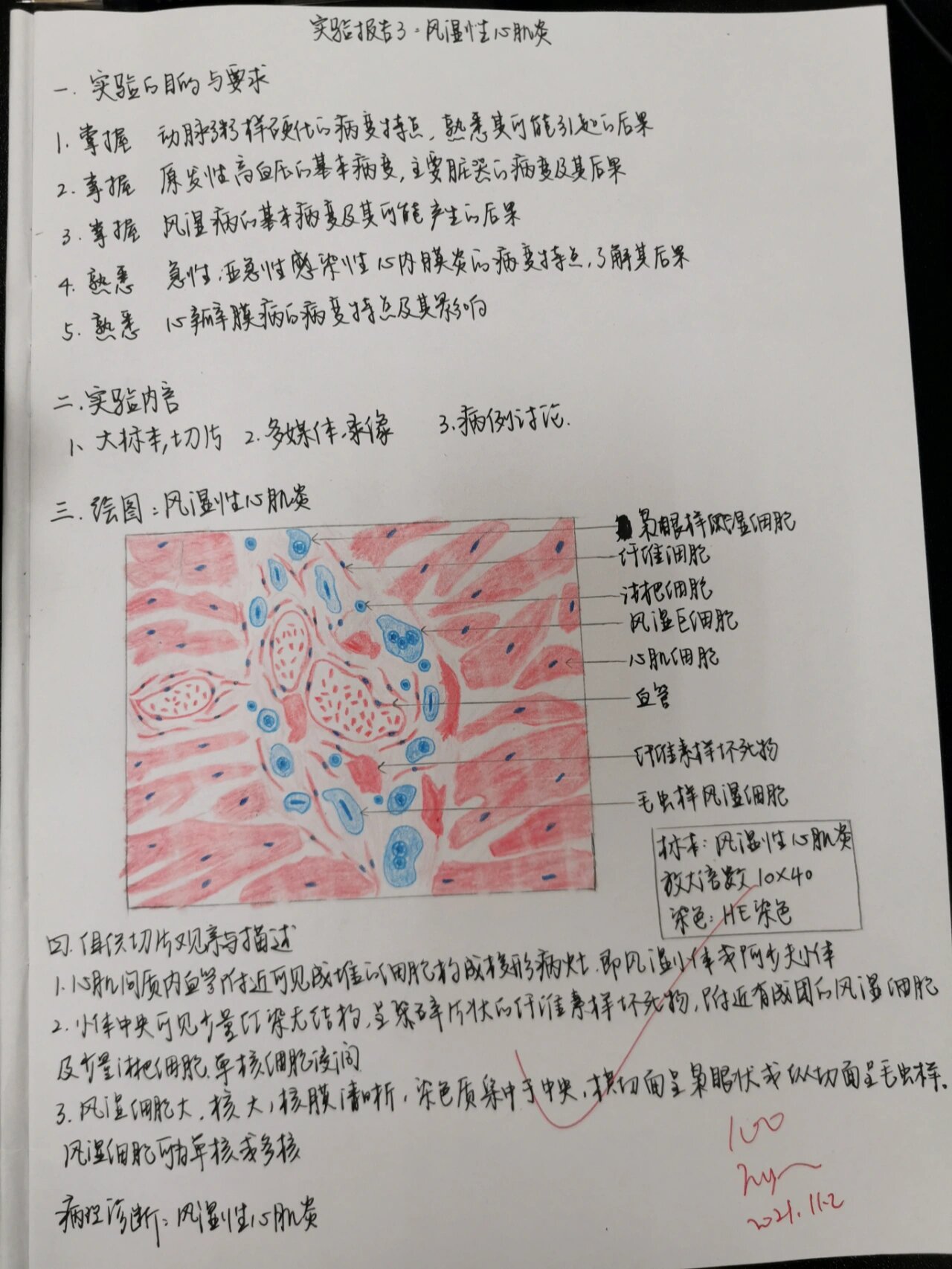 病理实验红蓝铅笔绘图3