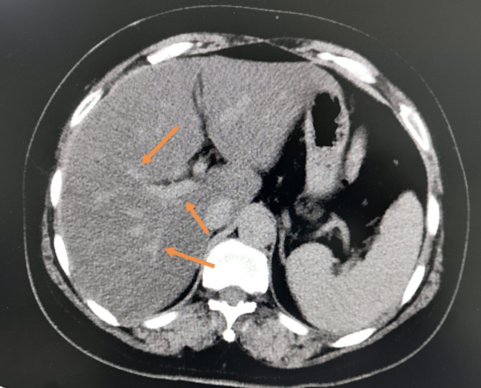 我姑姑今年51岁,一辈子没有结婚,做了一辈子的老姑