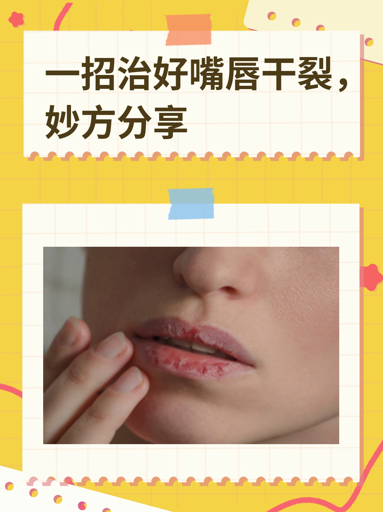一招治好嘴唇干裂,妙方分享