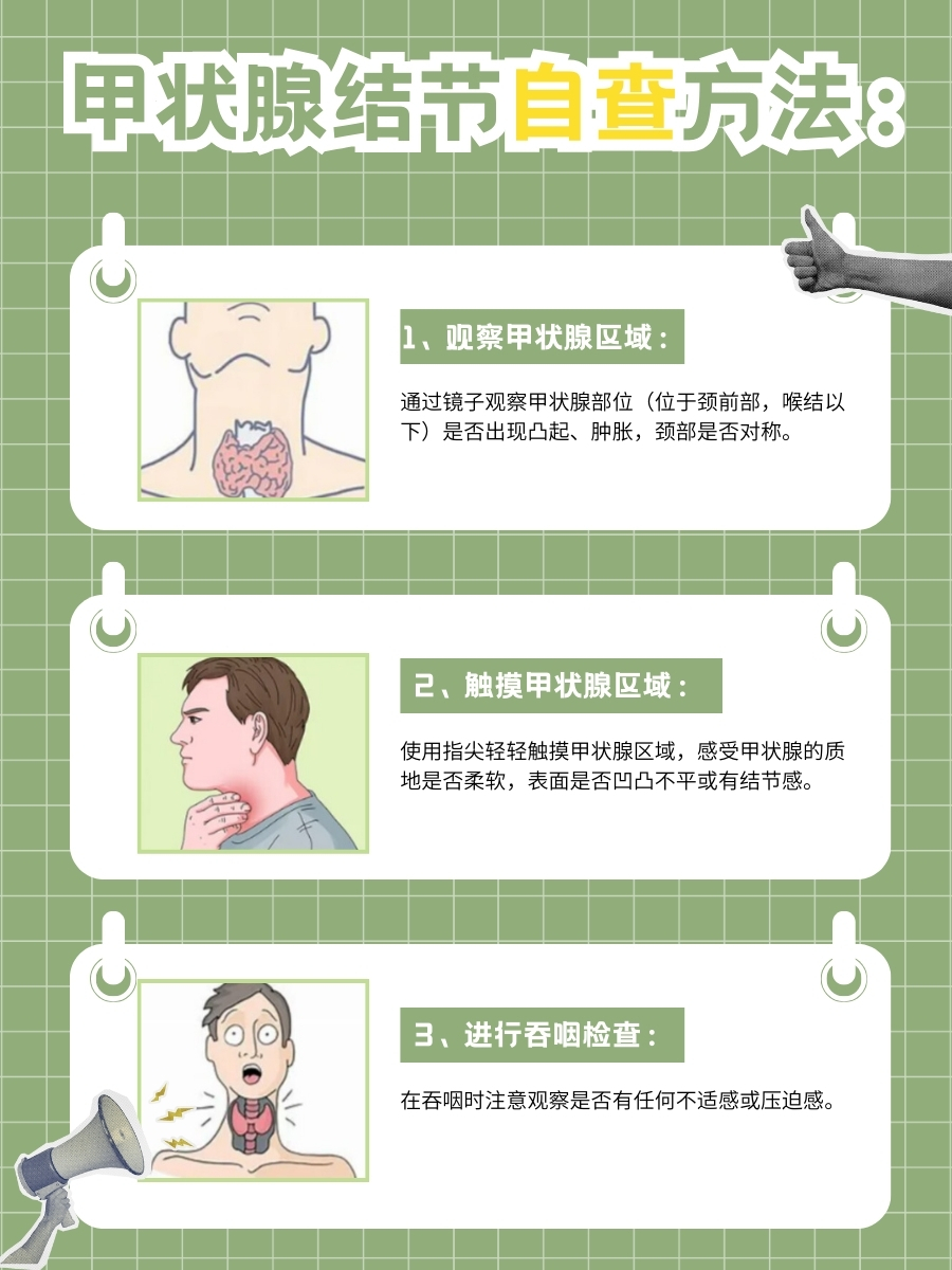 甲状腺结节恶变信号图片