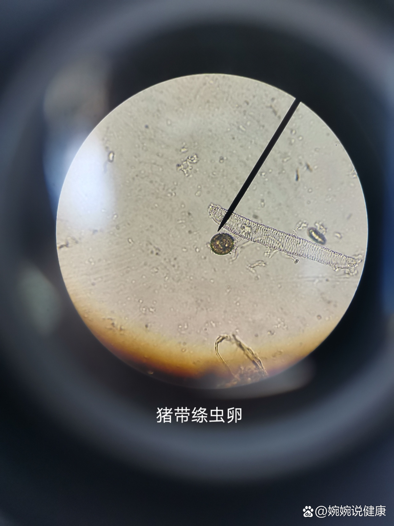 显微镜下各种寄生虫虫卵.