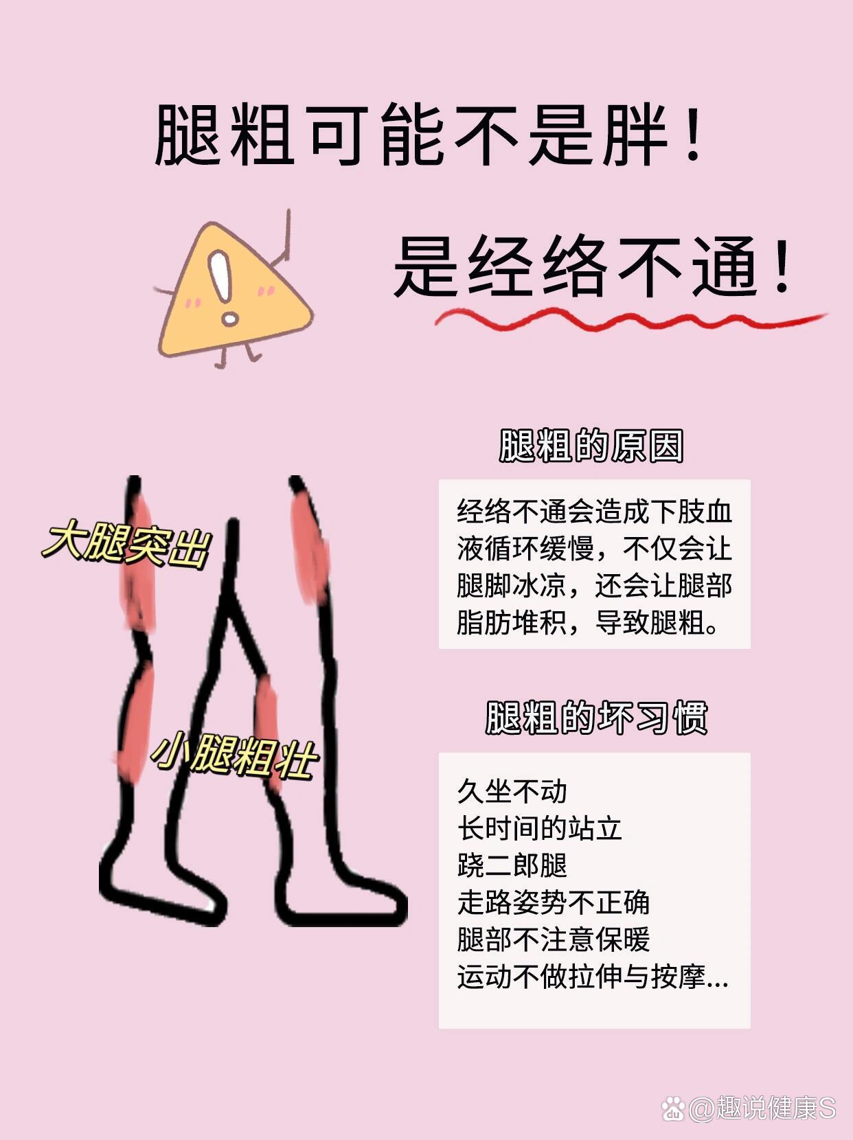 大腿粗的原因图片