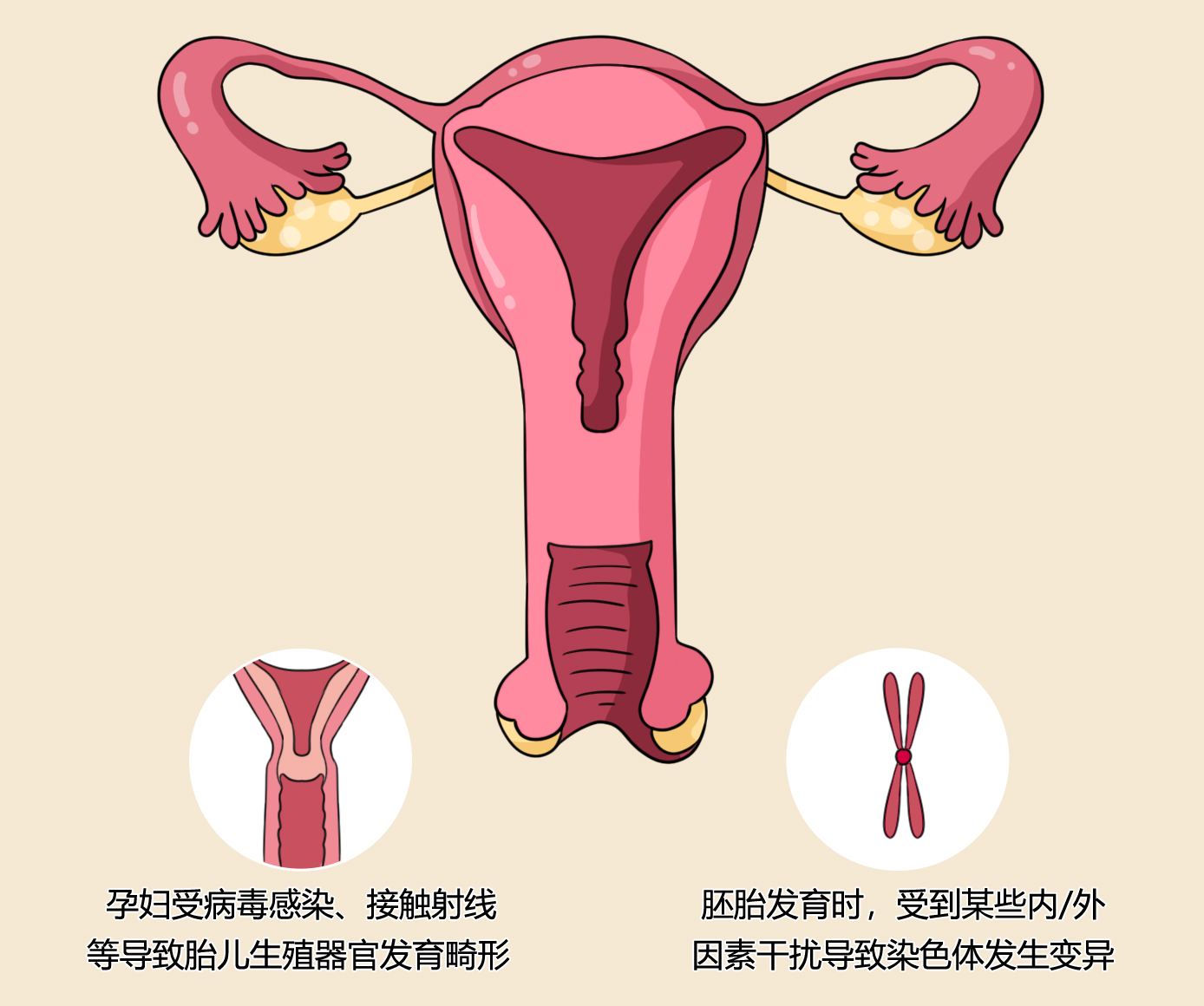 石女是怎么回事