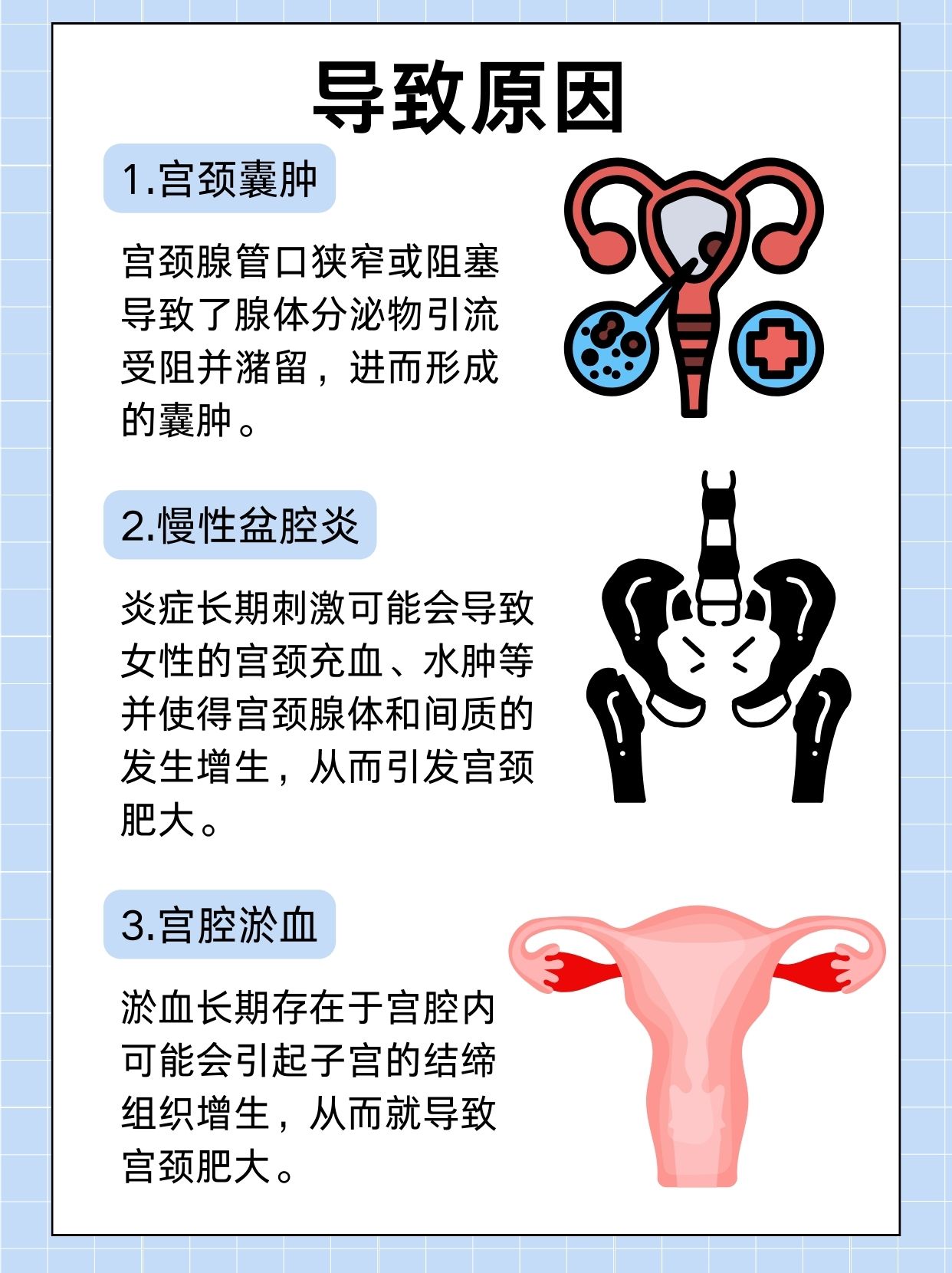 宫颈肥大:成因与治疗的必要性