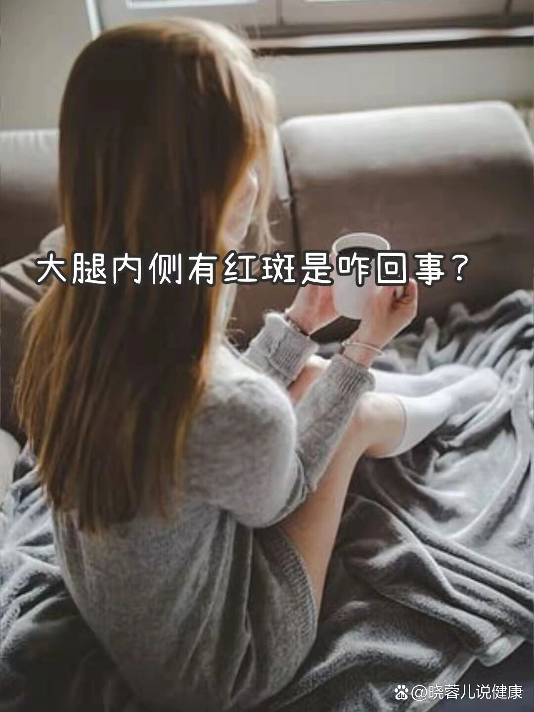 大腿内侧有红斑是咋回事?