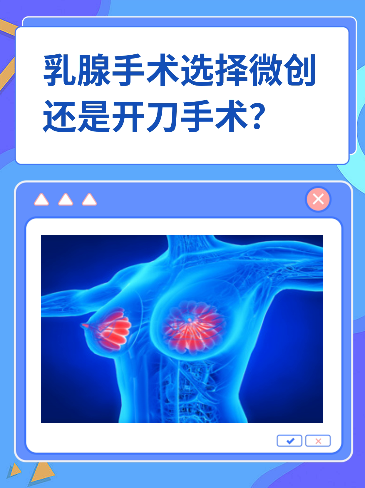 乳房开刀手术 费用图片