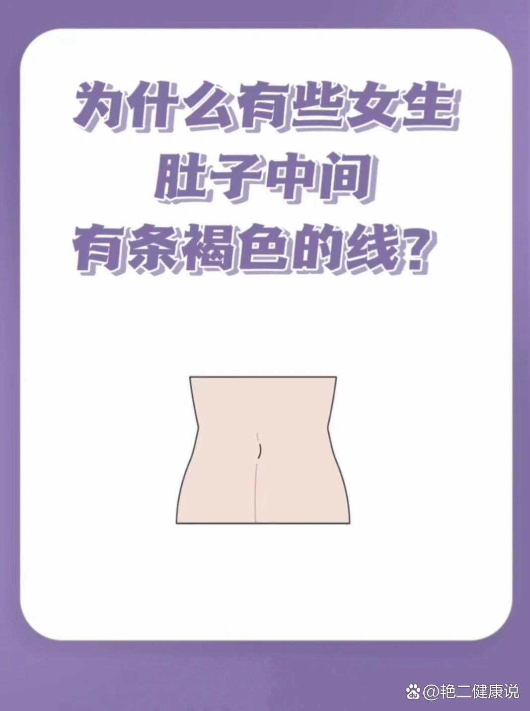 为什么女生的肚子上有一条褐色竖线71