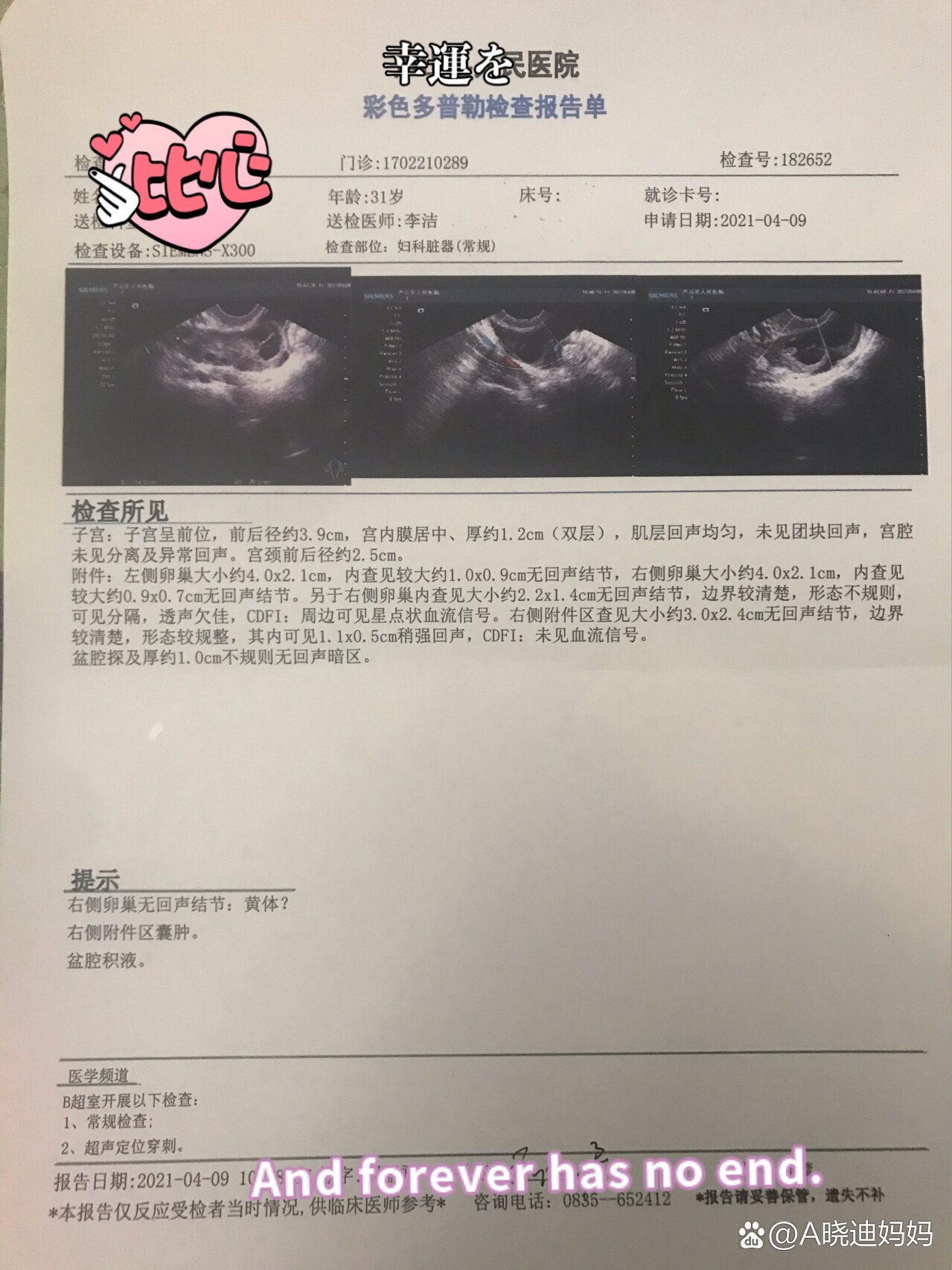 监测只有一个卵泡(监测只有一个卵泡怎么回事)