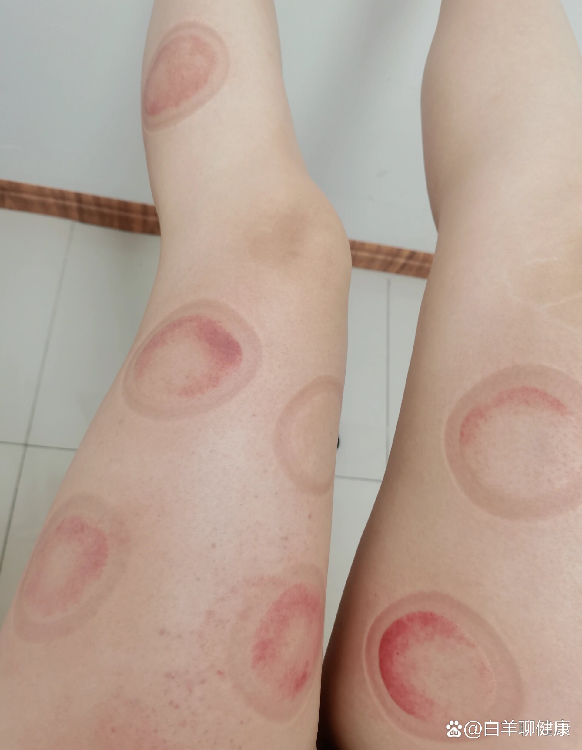瘦腿大法