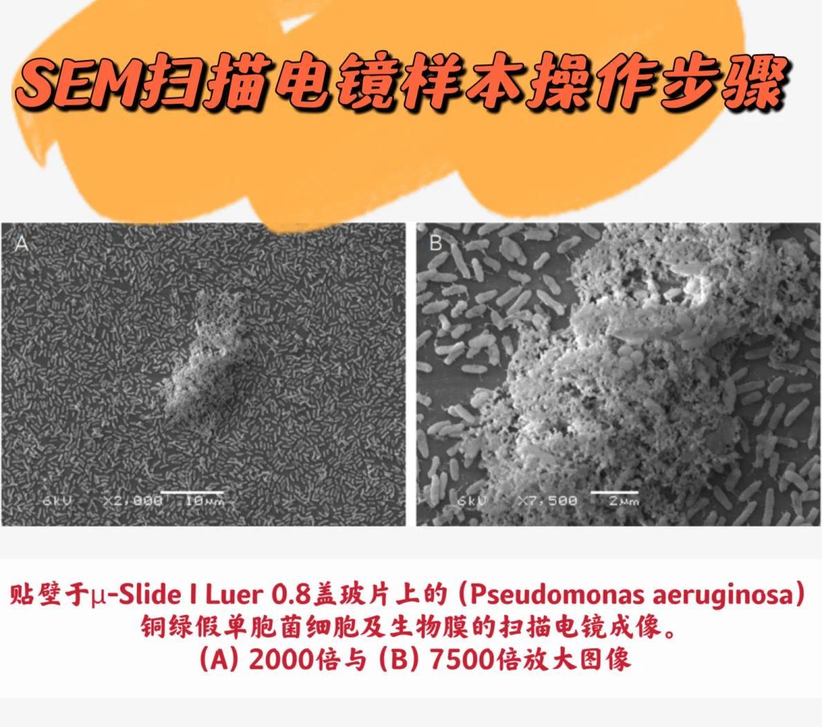 🔬可视化细菌生物膜与SEM标本制作指南