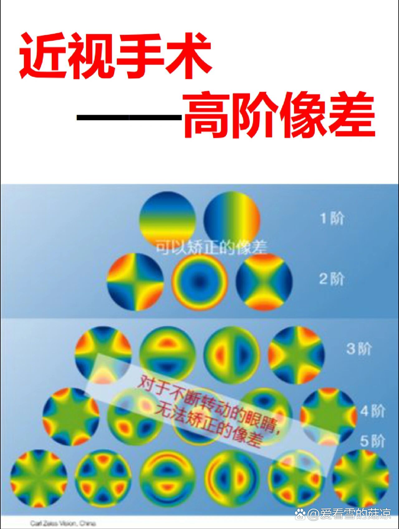 近视手术——高阶像差97