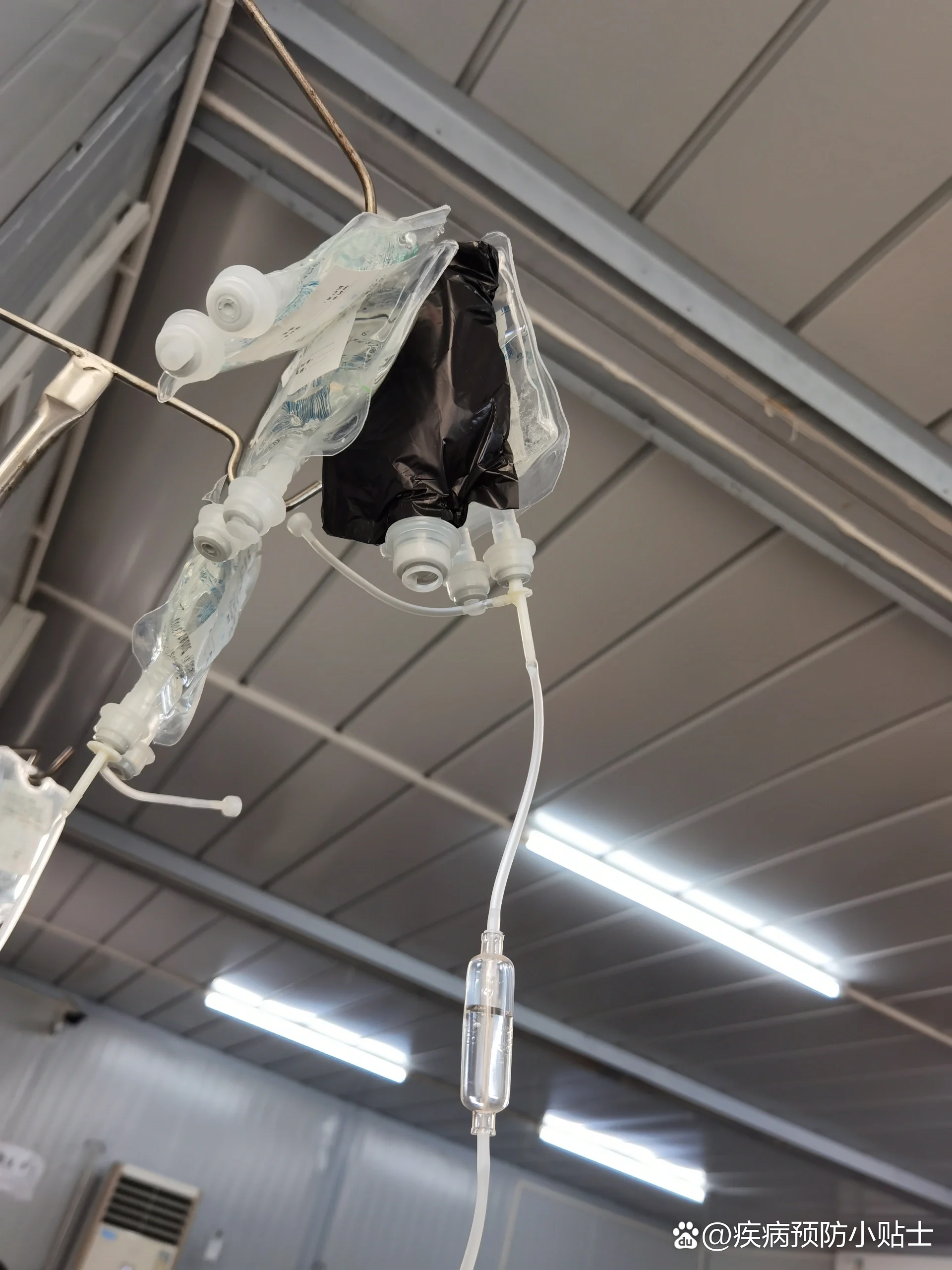 社区医院吊盐水真的香!