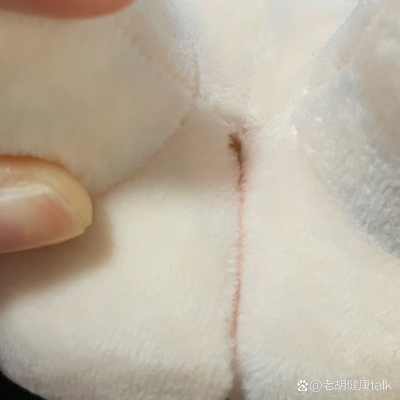 宝宝的屁股裂开