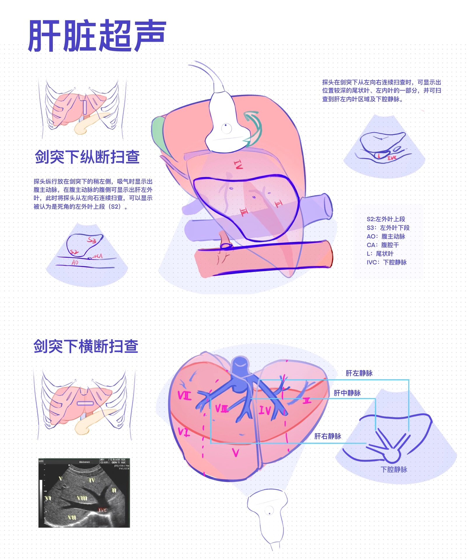 适合超声宝宝体质的肝脏解剖图 day23素材参考:原创 br>生产队的驴都