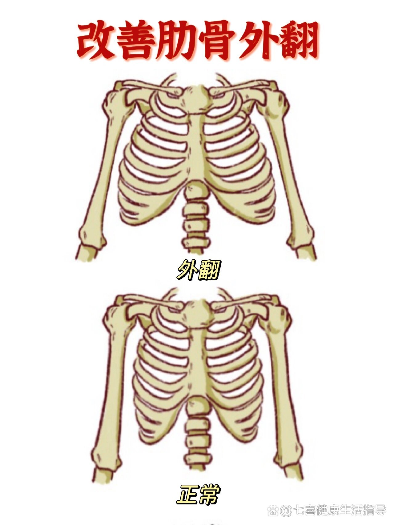 肋骨外翻女孩必练动作