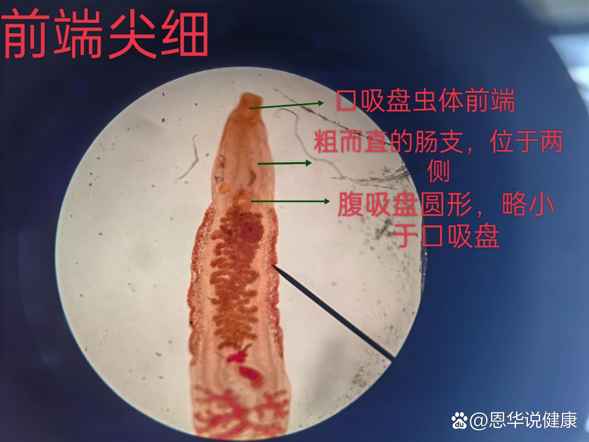 斜睾吸虫青蛙图片