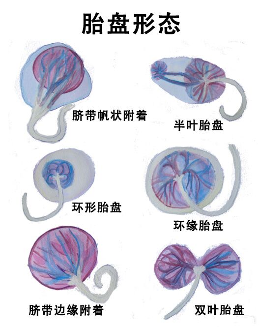  p>形状各异的胎盘,有的要格外小心哦 br>胎盘是胎儿与母体营养物质