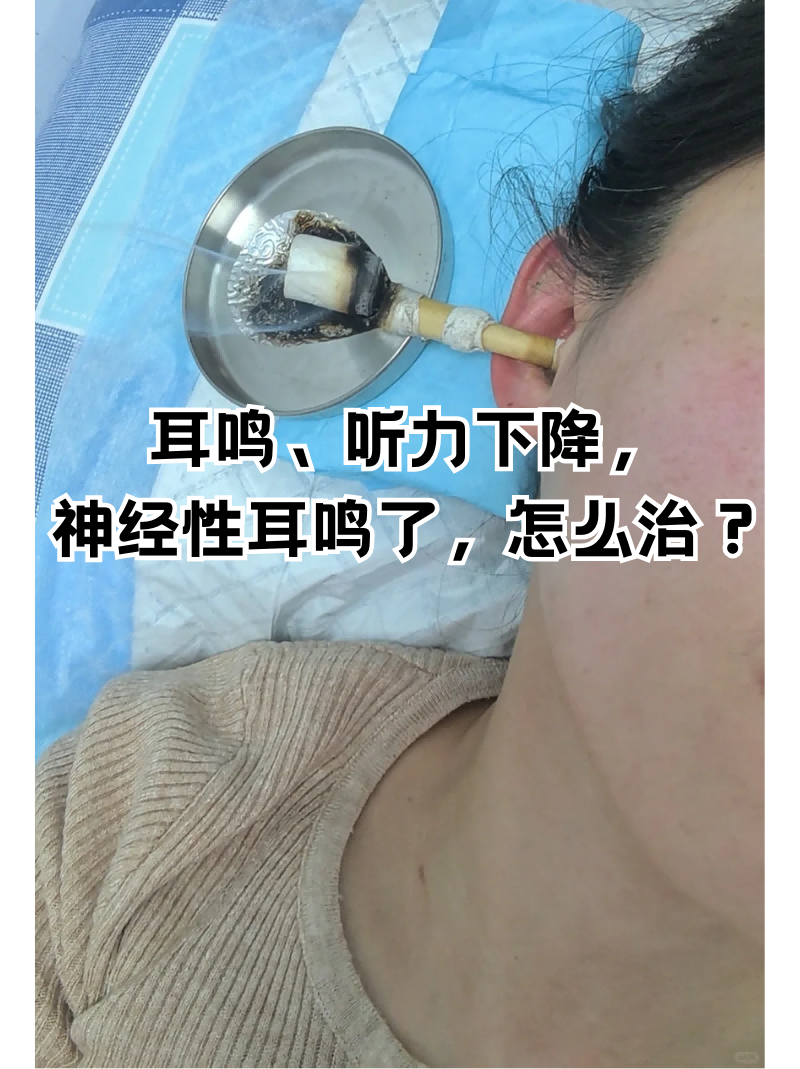 平眩胶囊治耳鸣效果图片