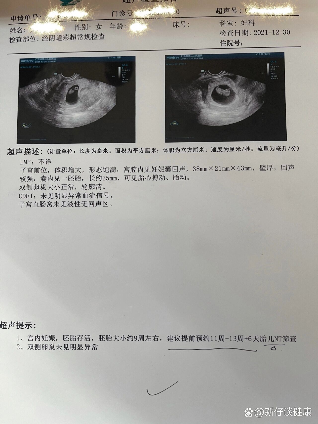 孕9周子宫位置图图片