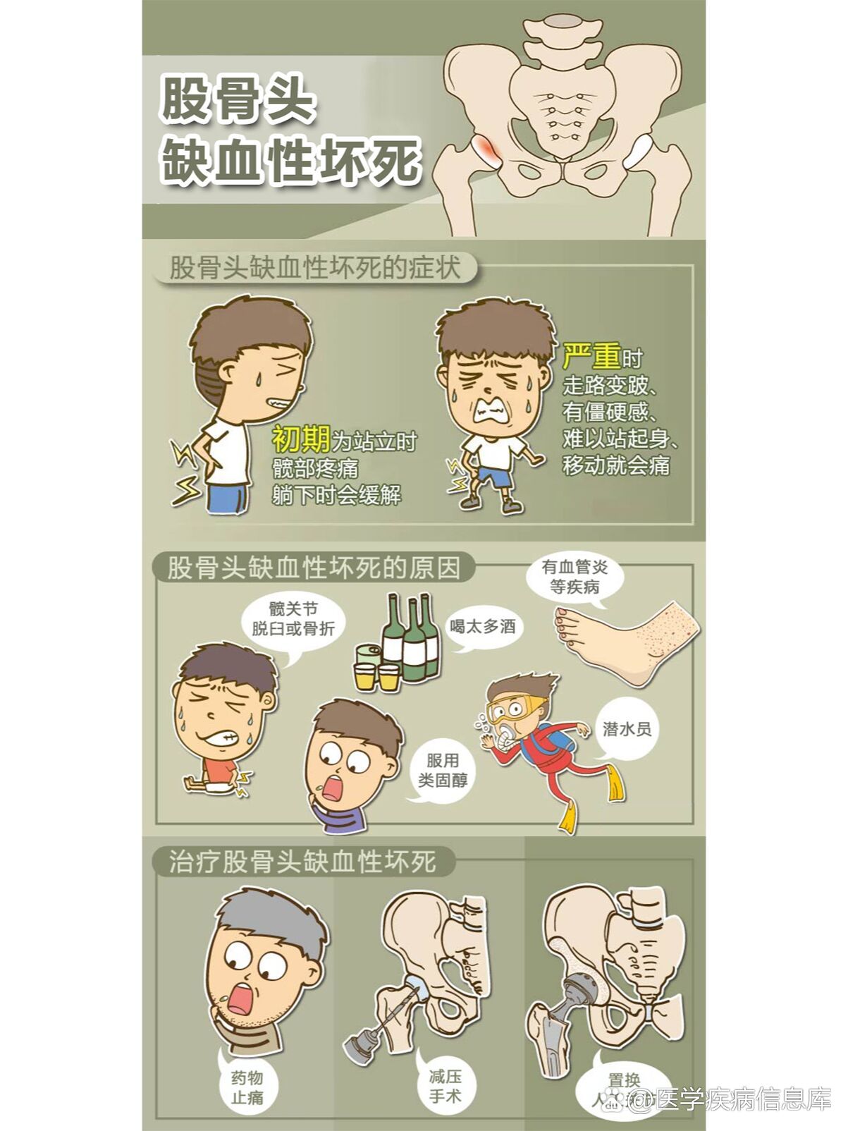股骨头坏死的常见症状和治疗