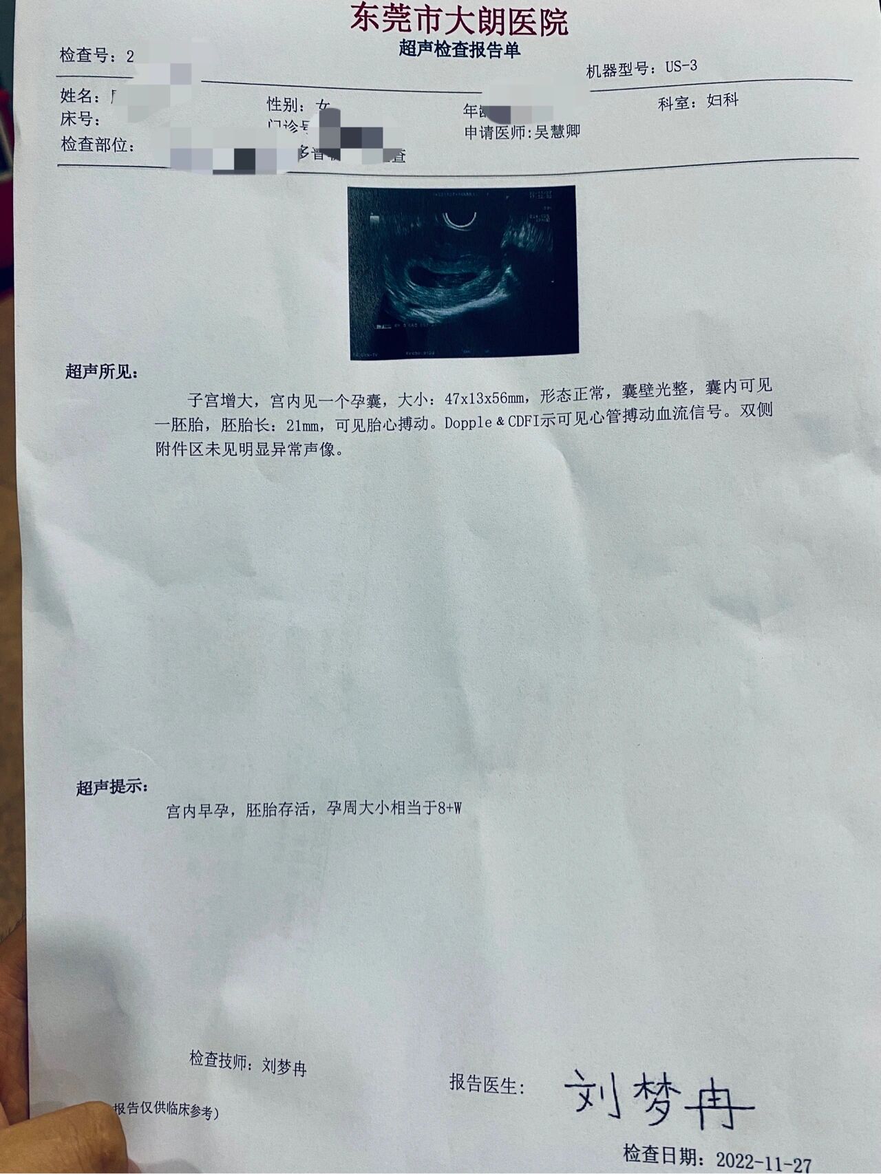 孕8周的阴超报告,一切健康